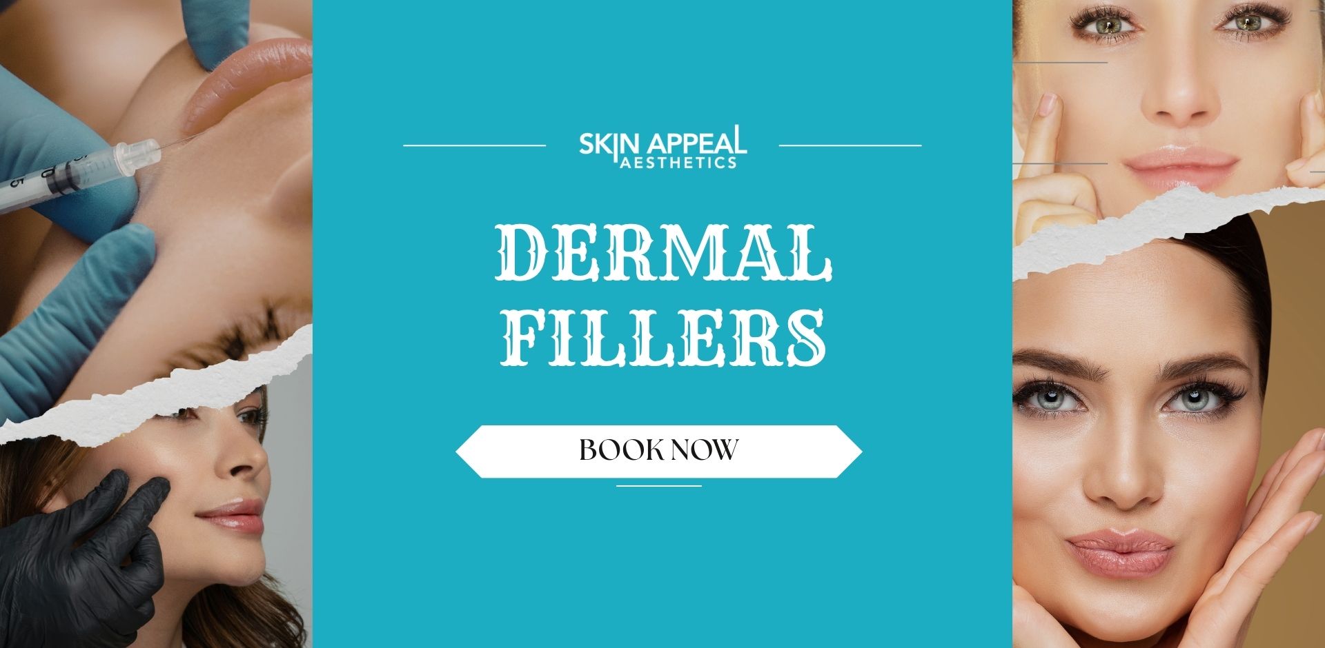 dermal fillers slide (1)