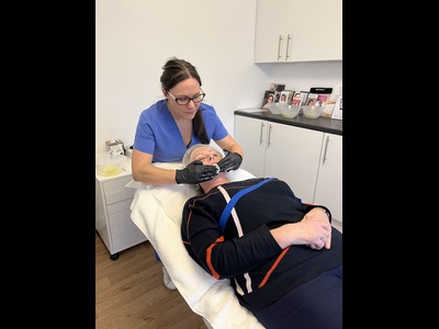 chemical peel