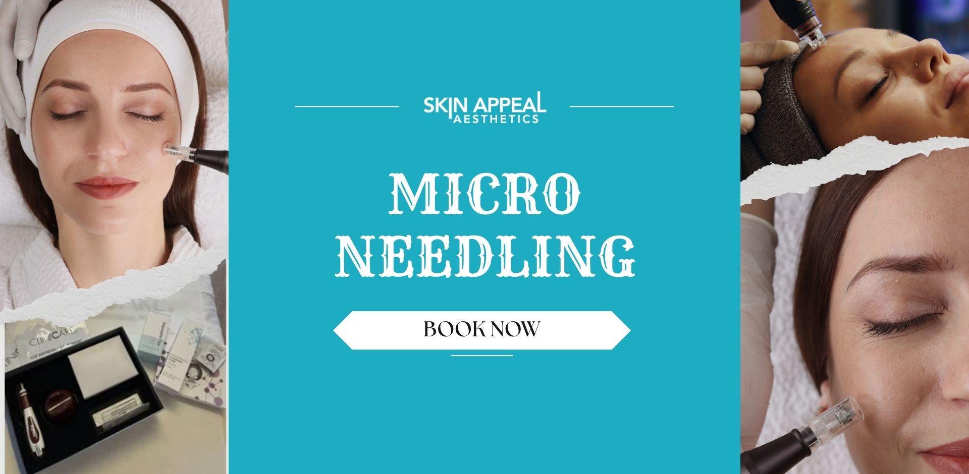 micro needling
