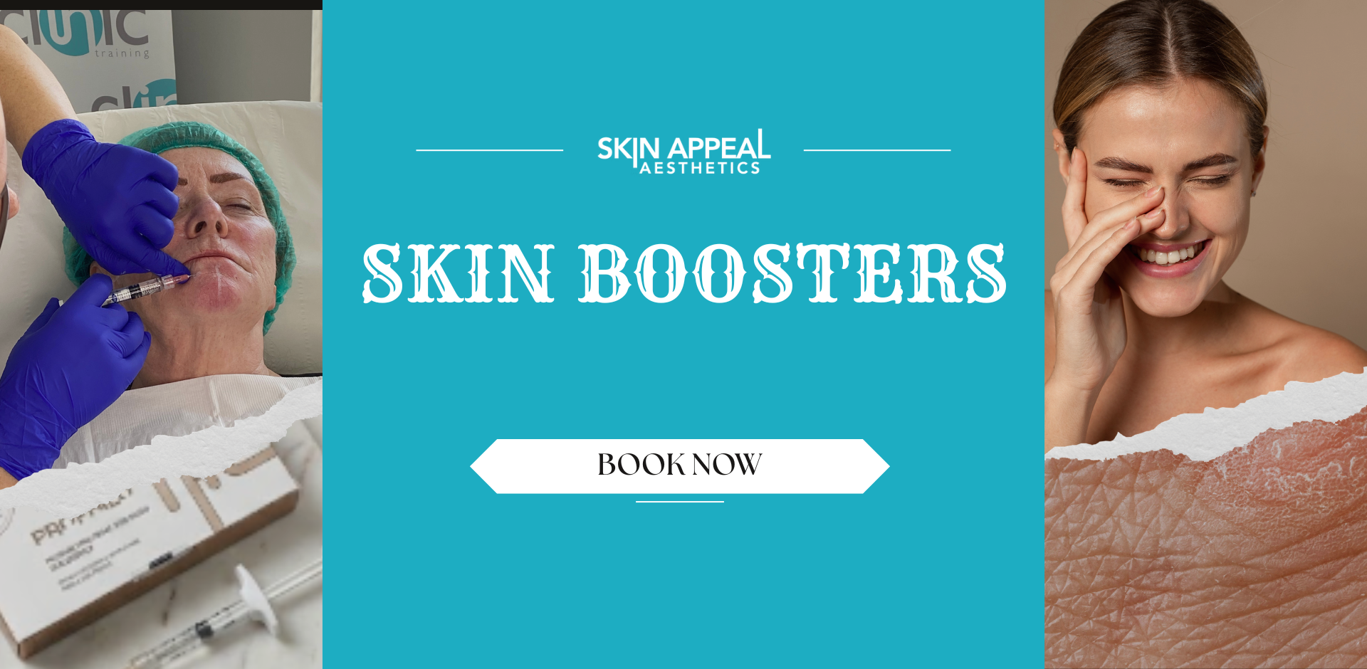 skin booster