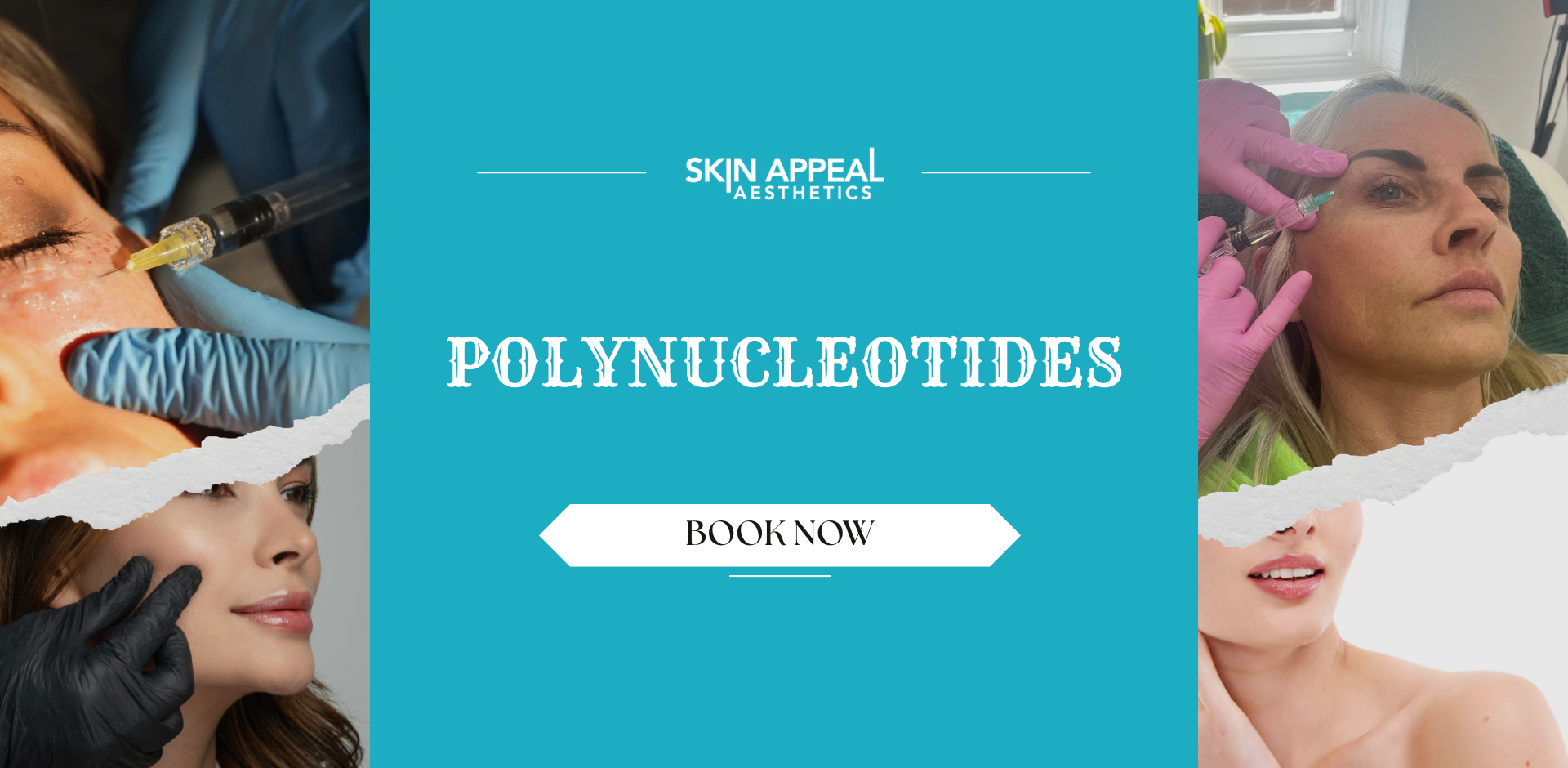 polynucleotidess
