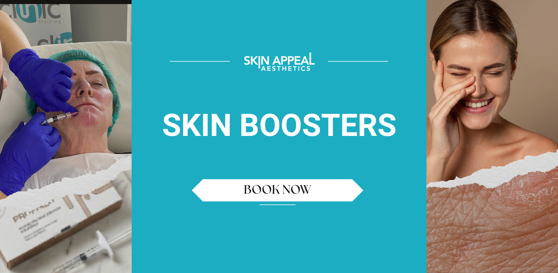 skin booster