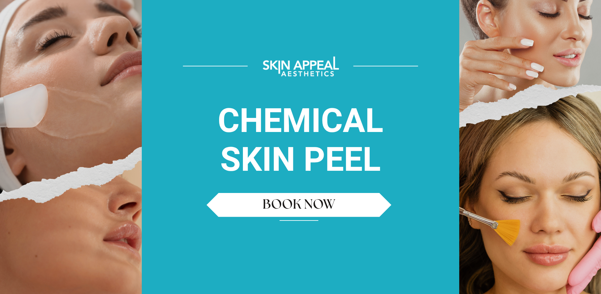 skin peel